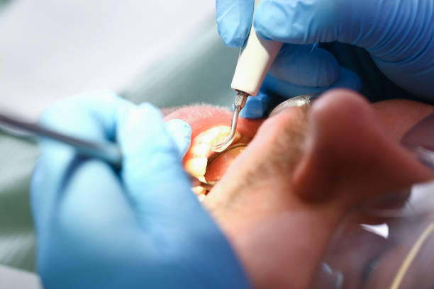 Best Emergency Denture Repair in Pryor Creek, OK